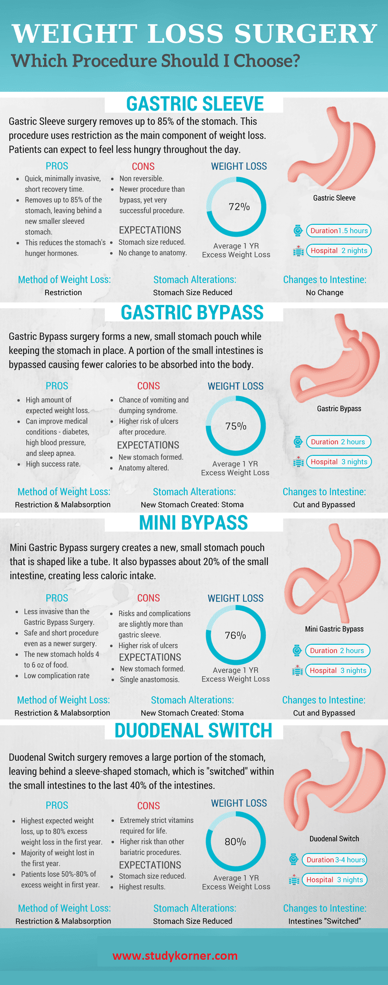 Bariatric Surgery Comparison Infographic What is the best weight loss surgery