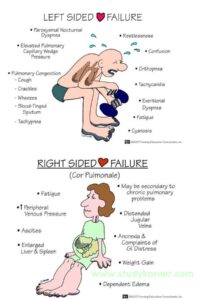 right sided heart failure vs left sided heart failure symptoms