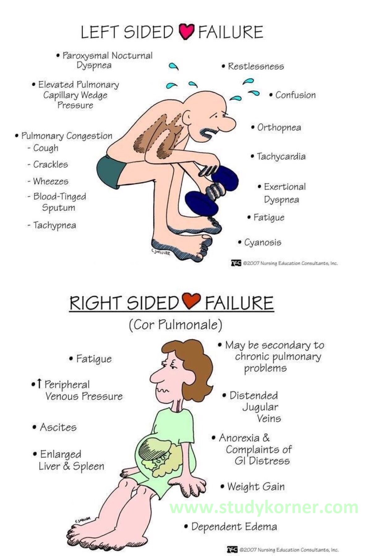 right sided heart failure vs left sided heart failure symptoms