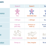 management of baby with low apgar score