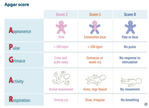 management of baby with low apgar score
