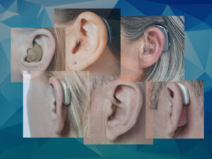 Hearing aid types and styles