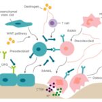 postmenopausal osteoporosis