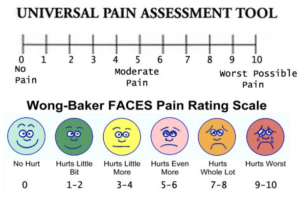 pain assessment tools