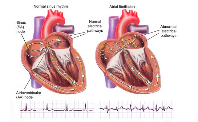 NCLEX Practice Questions: Quiz 860