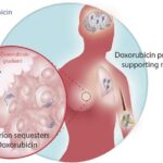doxorubicin for breast cancer