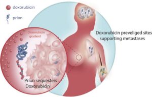 doxorubicin for breast cancer