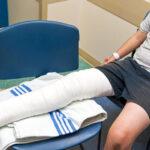 fractured femur bed rest