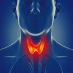 NCLEX-RN Quiz on Clinical Manifestations of Hypothyroidism