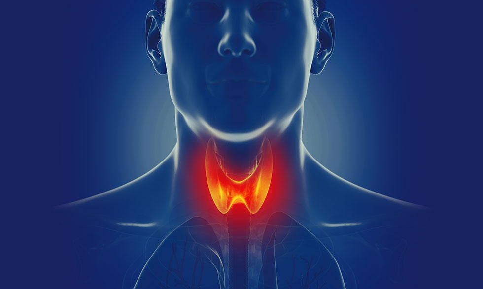 Clinical Manifestations of Hypothyroidism: An NCLEX-RN Quiz