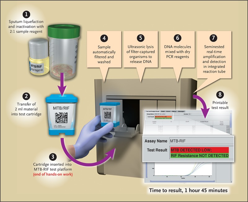Sample Genexpert MTB RIF Report Format For TB Diagnosis StudyPK