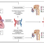 Fluid Overload in a Client with Heart Failure: Nursing Assessment and Interventions