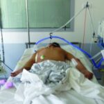 NCLEX Practice Quiz: Indications for Ventilator Support for ARDS
