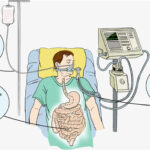 Nutritional Care in Acute and Chronic Illness
