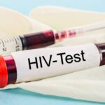Diagnostic Tests for HIV Infection