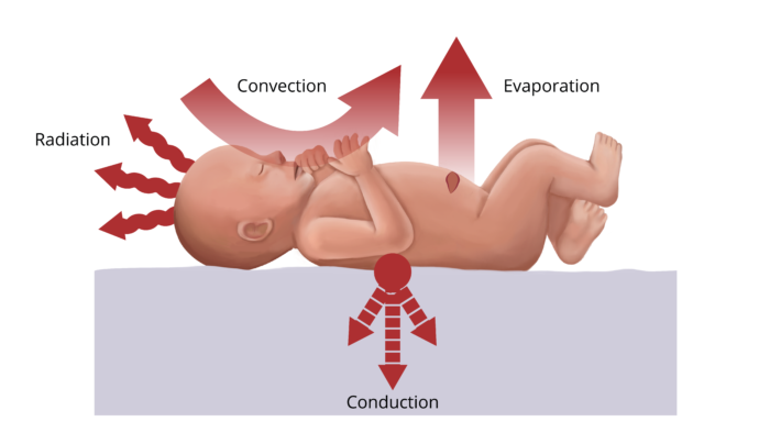 Neonatal Thermoregulation