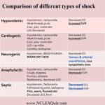 Understanding Shock A Guide for Healthcare Providers