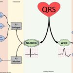 Critical Decision-making in Cardiac Emergencies