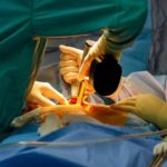 Gastric Mucosal Protective Agents