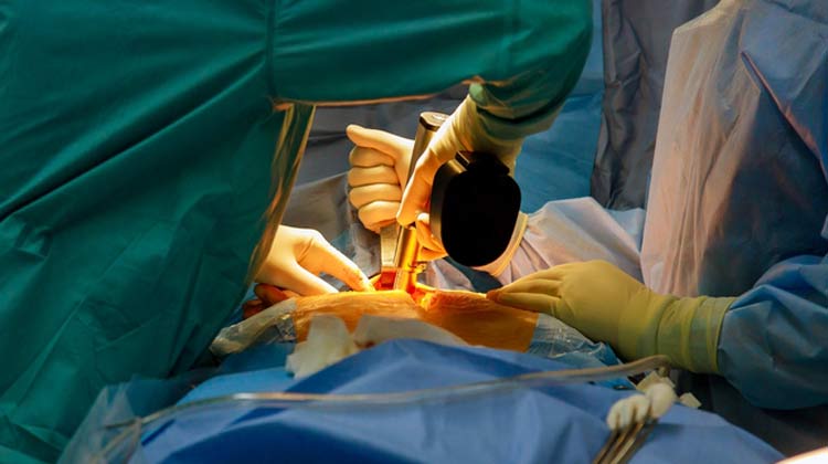 NCLEX Question on Gastric Mucosal Protective Agents