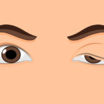 Nursing Care of the Patient with Myasthenia Gravis