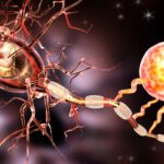 Multiple Sclerosis (MS)