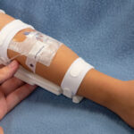 Nurse assessing a swollen and pale IV site with non-infusing fluid line